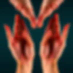 A close-up of two hands showing complete symmetry but lacking thumbs, illustrating Mirror Hand Syndrome.