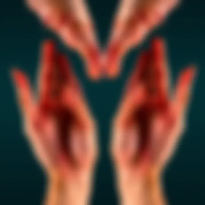 A close-up of two hands showing complete symmetry but lacking thumbs, illustrating Mirror Hand Syndrome.